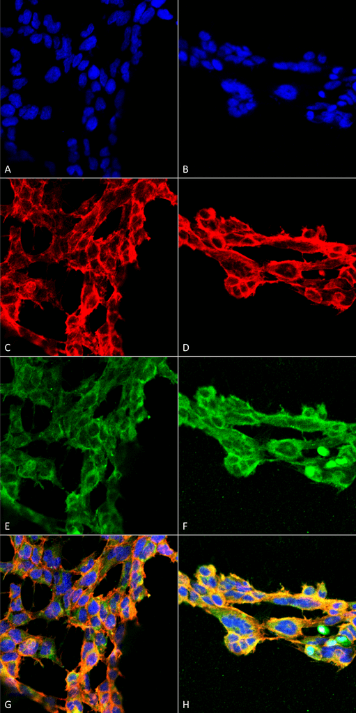 <p>Immunocytochemistry/Immunofluorescence analysis using Mouse Anti-7-Ketocholesterol Monoclonal Antibody, Clone 7E1 (SMC-512). Tissue: Embryonic kidney epithelial cell line (HEK293). Species: Human. Fixation: 5% Formaldehyde for 5 min. Primary Antibody: Mouse Anti-7-Ketocholesterol Monoclonal Antibody (SMC-512) at 1:50 for 30-60 min at RT. Secondary Antibody: Goat Anti-Mouse Alexa Fluor 488 at 1:1500 for 30-60 min at RT. Counterstain: Phalloidin Alexa Fluor 633 F-Actin stain; DAPI (blue) nuclear stain at 1:250, 1:50000 for 30-60 min at RT. Magnification: 20X (2X Zoom). (A,C,E,G) – Untreated. (B,D,F,H) – Cells cultured overnight with 50 µM H2O2. (A,B) DAPI (blue) nuclear stain. (C,D) Phalloidin Alexa Fluor 633 F-Actin stain. (E,F) 7-Ketocholesterol Antibody. (G,H) Composite. Courtesy of: Dr. Robert Burke, University of Victoria.</p>
