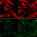 SMC-513_7-Ketocholesterol_Antibody_3F7_ICC-IF_Human_Embryonic-kidney-cells-HEK293_Composite_1.png