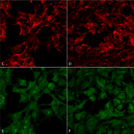 SMC-514_Malondialdehyde_Antibody_6H6_ICC-IF_Human_Embryonic-kidney-cells-HEK293_Composite_1.png