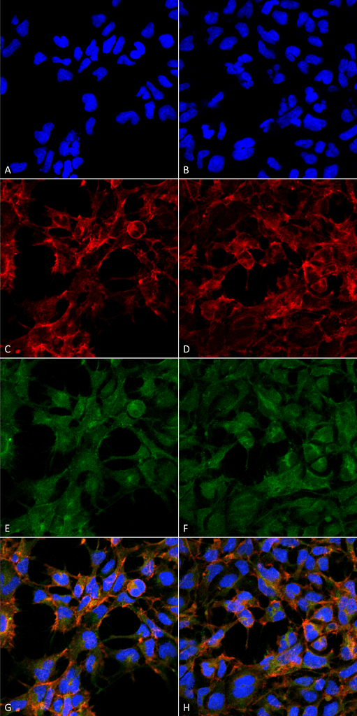<p>Immunocytochemistry/Immunofluorescence analysis using Mouse Anti-Malondialdehyde Monoclonal Antibody, Clone 6H6 (SMC-514). Tissue: Embryonic kidney epithelial cell line (HEK293). Species: Human. Fixation: 5% Formaldehyde for 5 min. Primary Antibody: Mouse Anti-Malondialdehyde Monoclonal Antibody (SMC-514) at 1:50 for 30-60 min at RT. Secondary Antibody: Goat Anti-Mouse Alexa Fluor 488 at 1:1500 for 30-60 min at RT. Counterstain: Phalloidin Alexa Fluor 633 F-Actin stain; DAPI (blue) nuclear stain at 1:250, 1:50000 for 30-60 min at RT. Magnification: 20X (2X Zoom). (A,C,E,G) – Untreated. (B,D,F,H) – Cells cultured overnight with 50 µM H2O2. (A,B) DAPI (blue) nuclear stain. (C,D) Phalloidin Alexa Fluor 633 F-Actin stain. (E,F) Malondialdehyde Antibody. (G,H) Composite. Courtesy of: Dr. Robert Burke, University of Victoria.</p>
