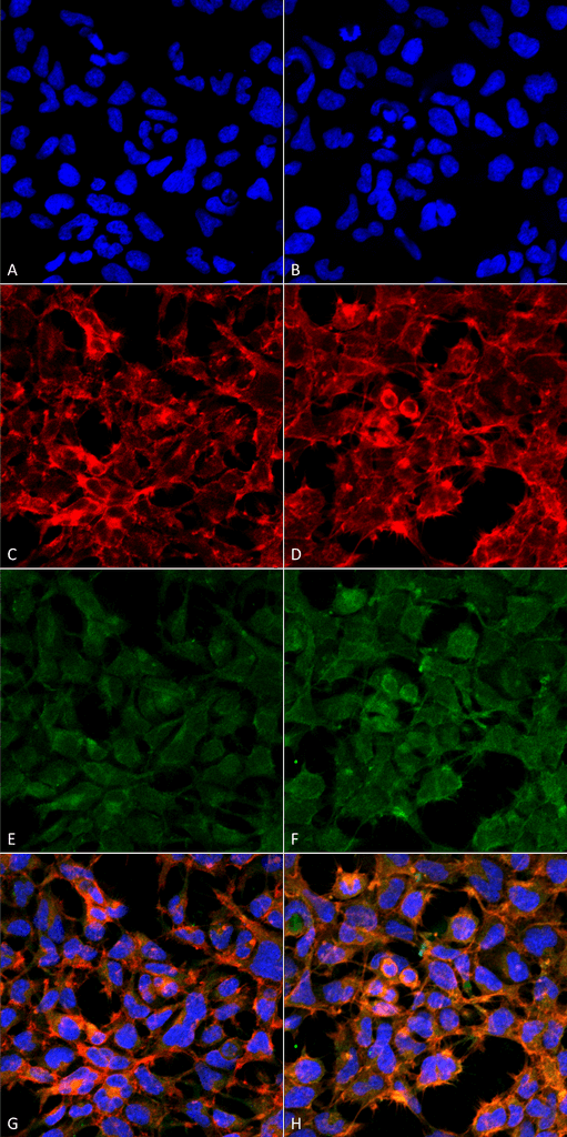 <p>Immunocytochemistry/Immunofluorescence analysis using Mouse Anti-Malondialdehyde Monoclonal Antibody, Clone 11E3 (SMC-515). Tissue: Embryonic kidney epithelial cell line (HEK293). Species: Human. Fixation: 5% Formaldehyde for 5 min. Primary Antibody: Mouse Anti-Malondialdehyde Monoclonal Antibody (SMC-515) at 1:50 for 30-60 min at RT. Secondary Antibody: Goat Anti-Mouse Alexa Fluor 488 at 1:1500 for 30-60 min at RT. Counterstain: Phalloidin Alexa Fluor 633 F-Actin stain; DAPI (blue) nuclear stain at 1:250, 1:50000 for 30-60 min at RT. Magnification: 20X (2X Zoom). (A,C,E,G) – Untreated. (B,D,F,H) – Cells cultured overnight with 50 µM H2O2. (A,B) DAPI (blue) nuclear stain. (C,D) Phalloidin Alexa Fluor 633 F-Actin stain. (E,F) Malondialdehyde Antibody. (G,H) Composite. Courtesy of: Dr. Robert Burke, University of Victoria.</p>
