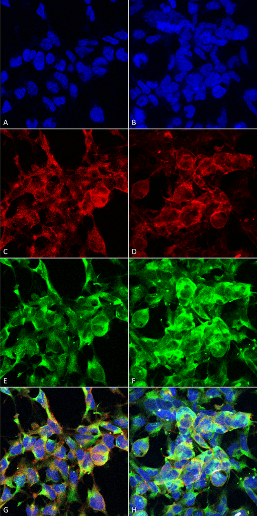 <p>Immunocytochemistry/Immunofluorescence analysis using Mouse Anti-Methylglyoxal Monoclonal Antibody, Clone 9E7 (SMC-516). Tissue: Embryonic kidney epithelial cell line (HEK293). Species: Human. Fixation: 5% Formaldehyde for 5 min. Primary Antibody: Mouse Anti-Methylglyoxal Monoclonal Antibody (SMC-516) at 1:50 for 30-60 min at RT. Secondary Antibody: Goat Anti-Mouse Alexa Fluor 488 at 1:1500 for 30-60 min at RT. Counterstain: Phalloidin Alexa Fluor 633 F-Actin stain; DAPI (blue) nuclear stain at 1:250, 1:50000 for 30-60 min at RT. Magnification: 20X (2X Zoom). (A,C,E,G) – Untreated. (B,D,F,H) – Cells cultured overnight with 50 µM H2O2. (A,B) DAPI (blue) nuclear stain. (C,D) Phalloidin Alexa Fluor 633 F-Actin stain. (E,F) Methylglyoxal Antibody. (G,H) Composite. Courtesy of: Dr. Robert Burke, University of Victoria.</p>
