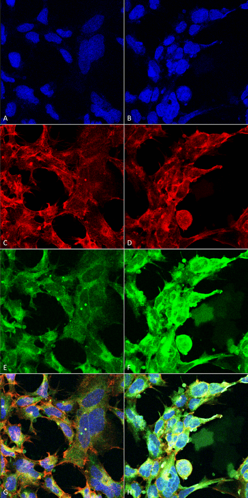 <p>Immunocytochemistry/Immunofluorescence analysis using Mouse Anti-Methylglyoxal Monoclonal Antibody, Clone 9F11 (SMC-517). Tissue: Embryonic kidney epithelial cell line (HEK293). Species: Human. Fixation: 5% Formaldehyde for 5 min. Primary Antibody: Mouse Anti-Methylglyoxal Monoclonal Antibody (SMC-517) at 1:50 for 30-60 min at RT. Secondary Antibody: Goat Anti-Mouse Alexa Fluor 488 at 1:1500 for 30-60 min at RT. Counterstain: Phalloidin Alexa Fluor 633 F-Actin stain; DAPI (blue) nuclear stain at 1:250, 1:50000 for 30-60 min at RT. Magnification: 20X (2X Zoom). (A,C,E,G) – Untreated. (B,D,F,H) – Cells cultured overnight with 50 µM H2O2. (A,B) DAPI (blue) nuclear stain. (C,D) Phalloidin Alexa Fluor 633 F-Actin stain. (E,F) Methylglyoxal Antibody. (G,H) Composite. Courtesy of: Dr. Robert Burke, University of Victoria.</p>
