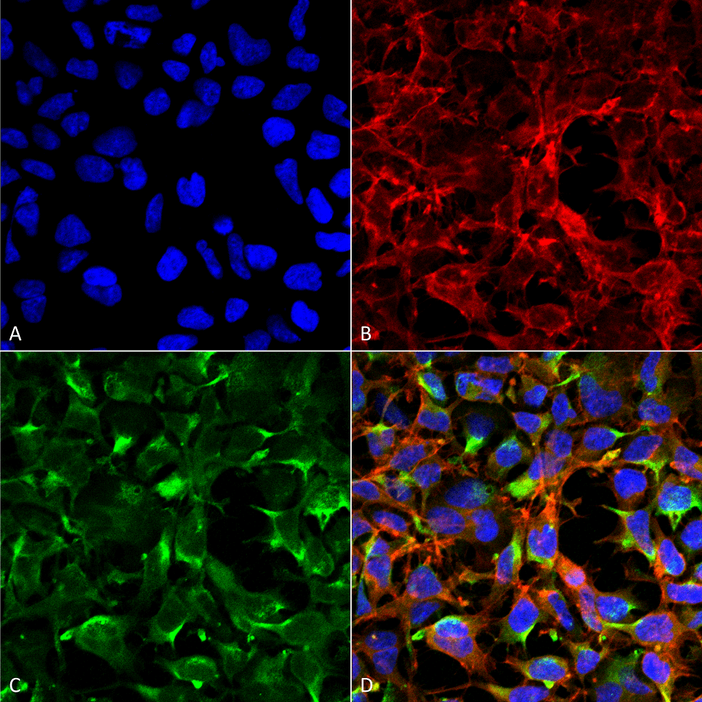 <p>Immunocytochemistry/Immunofluorescence analysis using Mouse Anti-Dityrosine Monoclonal Antibody, Clone 7D4 (SMC-520). Tissue: Embryonic kidney cells (HEK293) cultured overnight with 50 µM H2O2. Species: Human. Fixation: 5% Formaldehyde for 5 min. Primary Antibody: Mouse Anti-Dityrosine Monoclonal Antibody (SMC-520) at 1:50 for 30-60 min at RT. Secondary Antibody: Goat Anti-Mouse Alexa Fluor 488 at 1:1500 for 30-60 min at RT. Counterstain: Phalloidin Alexa Fluor 633 F-Actin stain; DAPI (blue) nuclear stain at 1:250, 1:50000 for 30-60 min at RT. Localization: Cytoplasmic. Magnification: 20X (2X Zoom). (A) DAPI (blue) nuclear stain. (B) Phalloidin Alexa Fluor 633 F-Actin stain. (C) Dityrosine Antibody. (D) Composite. Courtesy of: Dr. Robert Burke, University of Victoria.</p>

