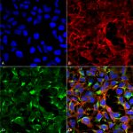 SMC-520_Dityrosine_Antibody_7D4_ICC-IF_Human_Embryonic-kidney-cells-HEK293-H2O2_20X-2X-Zoom_Composite_1.png