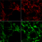 SMC-521_Dityrosine_Antibody_10A6_ICC-IF_Human_Embryonic-kidney-cells-HEK293_20X-2X-Zoom_Composite_1.png