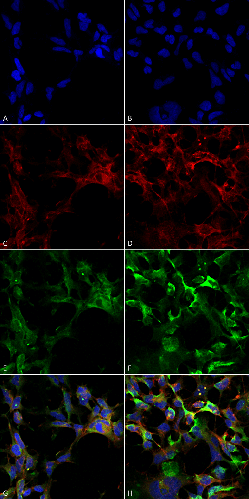 <p>Immunocytochemistry/Immunofluorescence analysis using Mouse Anti-Dityrosine Monoclonal Antibody, Clone 10A6 (SMC-521). Tissue: Embryonic kidney epithelial cell line (HEK293). Species: Human. Fixation: 5% Formaldehyde for 5 min. Primary Antibody: Mouse Anti-Dityrosine Monoclonal Antibody (SMC-521) at 1:50 for 30-60 min at RT. Secondary Antibody: Goat Anti-Mouse Alexa Fluor 488 at 1:1500 for 30-60 min at RT. Counterstain: Phalloidin Alexa Fluor 633 F-Actin stain; DAPI (blue) nuclear stain at 1:250, 1:50000 for 30-60 min at RT. Localization: Cytoplasmic. Magnification: 20X (2X Zoom). (A,C,E,G) – Untreated. (B,D,F,H) – Cells cultured overnight with 50 µM H2O2. (A,B) DAPI (blue) nuclear stain. (C,D) Phalloidin Alexa Fluor 633 F-Actin stain. (E,F) Dityrosine Antibody. (G,H) Composite. Courtesy of: Dr. Robert Burke, University of Victoria.</p>
