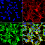 SMC-522_Sulfotyrosine_Antibody_12B11_ICC-IF_Human_Embryonic-kidney-cells-HEK293_20X-2X-Zoom_Composite_1.png