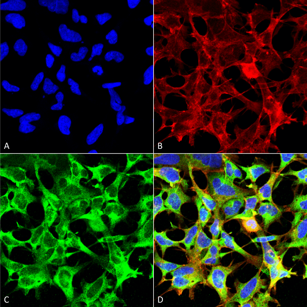 <p>Immunocytochemistry/Immunofluorescence analysis using Mouse Anti-Sulfotyrosine Monoclonal Antibody, Clone 7C5 (SMC-522). Tissue: Embryonic kidney epithelial cell line (HEK293). Species: Human. Fixation: 5% Formaldehyde for 5 min. Primary Antibody: Mouse Anti-Sulfotyrosine Monoclonal Antibody (SMC-522) at 1:50 for 30-60 min at RT. Secondary Antibody: Goat Anti-Mouse Alexa Fluor 488 at 1:1500 for 30-60 min at RT. Counterstain: Phalloidin Alexa Fluor 633 F-Actin stain; DAPI (blue) nuclear stain at 1:250, 1:50000 for 30-60 min at RT. Localization: Cytoplasmic. Magnification: 20X (2X Zoom). (A) DAPI (blue) nuclear stain. (B) Phalloidin Alexa Fluor 633 F-Actin stain. (C) Sulfotyrosine Antibody. (D) Composite. Courtesy of: Dr. Robert Burke, University of Victoria.</p>
