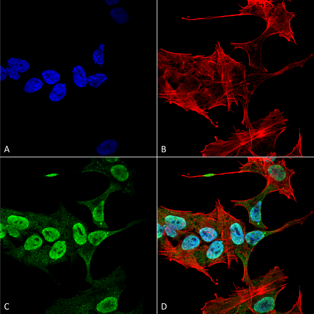 <p>Immunocytochemistry/Immunofluorescence analysis using Mouse Anti-Alpha Synuclein Monoclonal Antibody, Clone 3C11 (SMC-530). Tissue: Neuroblastoma cell line (SK-N-BE). Species: Human. Fixation: 4% Formaldehyde for 15 min at RT. Primary Antibody: Mouse Anti-Alpha Synuclein Monoclonal Antibody (SMC-530) at 1:100 for 60 min at RT. Secondary Antibody: Goat Anti-Mouse ATTO 488 at 1:200 for 60 min at RT. Counterstain: Phalloidin Texas Red F-Actin stain; DAPI (blue) nuclear stain at 1:1000, 1:5000 for 60 min at RT, 5 min at RT. Localization: Cytoplasm: weak; Nucleus: Med. Magnification: 60X. (A) DAPI (blue) nuclear stain. (B) Phalloidin Texas Red F-Actin stain. (C) Alpha Synuclein Antibody. (D) Composite.</p>
