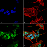 SMC-530_Alpha-Synuclein_Antibody_3C11_ICC-IF_Human_Neuroblastoma-cell-line-SK-N-BE_60X_Composite_1.png