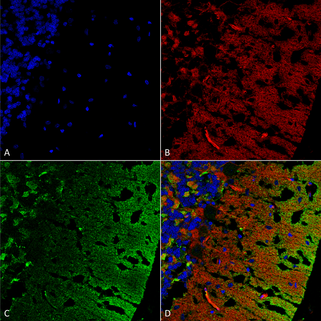 <p>Immunohistochemistry analysis using Mouse Anti-Alpha Synuclein Monoclonal Antibody, Clone 3C11 (SMC-530). Tissue: cerebellum. Species: Rat. Fixation: Formalin fixed, paraffin embedded. Primary Antibody: Mouse Anti-Alpha Synuclein Monoclonal Antibody (SMC-530) at 1:25 for 1 hour at RT. Secondary Antibody: Goat Anti-Mouse IgG: Alexa Fluor 488. Counterstain: Actin-binding Phalloidin-Alexa Fluor 633; DAPI (blue) nuclear stain. Magnification: 63X. (A) DAPI (blue) nuclear stain. (B) Phalloidin Alexa Fluor 633 F-Actin stain. (C) Alpha Synuclein Antibody (D) Composite.</p>
