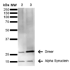 Mouse Anti-Alpha Synuclein Antibody [3C11] used in Western Blot (WB) on Human Brain (SMC-530)