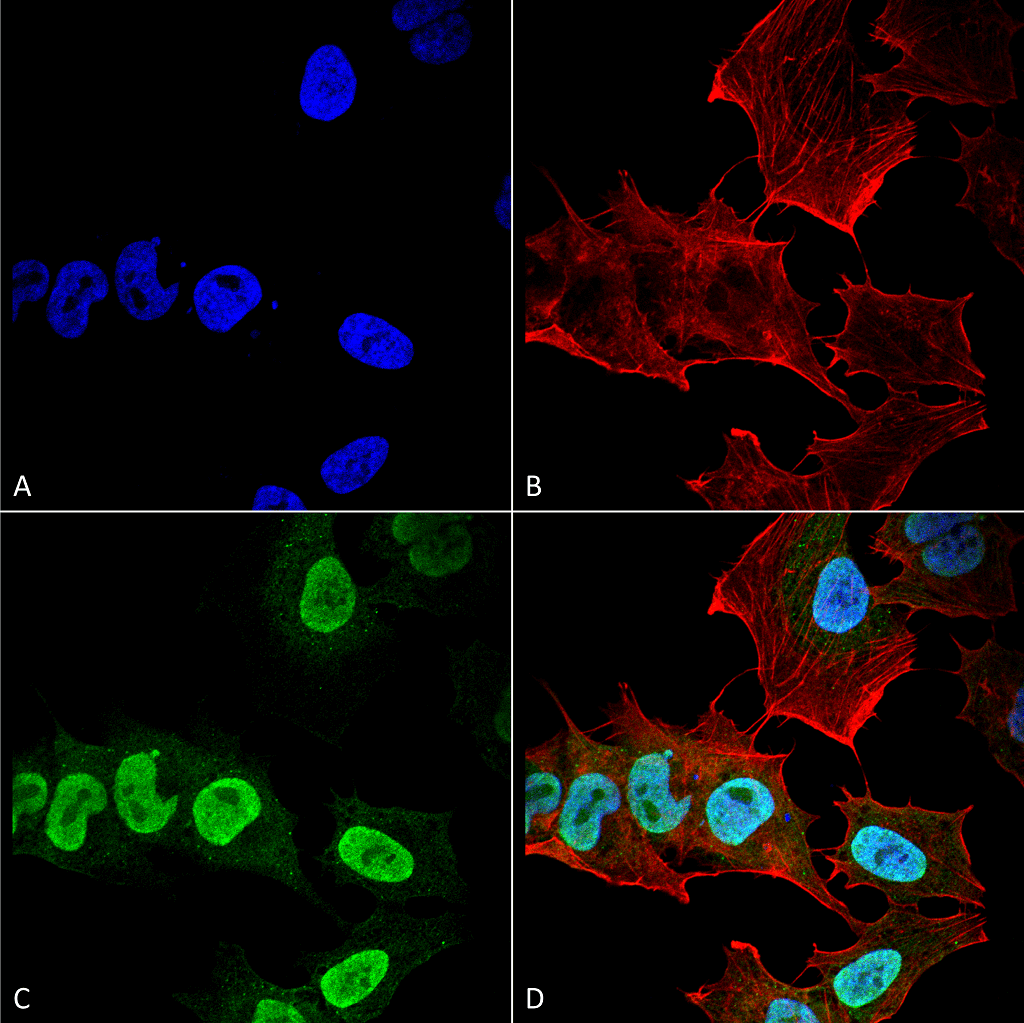 <p>Immunocytochemistry/Immunofluorescence analysis using Mouse Anti-Alpha Synuclein Monoclonal Antibody, Clone 10H7 (SMC-531). Tissue: Neuroblastoma cell line (SK-N-BE). Species: Human. Fixation: 4% Formaldehyde for 15 min at RT. Primary Antibody: Mouse Anti-Alpha Synuclein Monoclonal Antibody (SMC-531) at 1:100 for 60 min at RT. Secondary Antibody: Goat Anti-Mouse ATTO 488 at 1:200 for 60 min at RT. Counterstain: Phalloidin Texas Red F-Actin stain; DAPI (blue) nuclear stain at 1:1000, 1:5000 for 60 min at RT, 5 min at RT. Localization: Cytoplasm: weak; Nucleus: Med. Magnification: 60X. (A) DAPI (blue) nuclear stain. (B) Phalloidin Texas Red F-Actin stain. (C) Alpha Synuclein Antibody. (D) Composite.</p>
