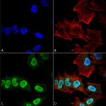 SMC-531_Alpha-Synuclein_Antibody_10H7_ICC-IF_Human_Neuroblastoma-cell-line-SK-N-BE_60X_Composite_1.png