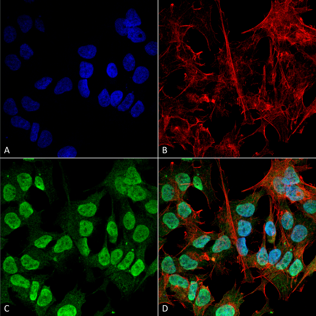 <p>Immunocytochemistry/Immunofluorescence analysis using Mouse Anti-Alpha Synuclein Monoclonal Antibody, Clone 3F8 (SMC-532). Tissue: Neuroblastoma cell line (SK-N-BE). Species: Human. Fixation: 4% Formaldehyde for 15 min at RT. Primary Antibody: Mouse Anti-Alpha Synuclein Monoclonal Antibody (SMC-532) at 1:100 for 60 min at RT. Secondary Antibody: Goat Anti-Mouse ATTO 488 at 1:200 for 60 min at RT. Counterstain: Phalloidin Texas Red F-Actin stain; DAPI (blue) nuclear stain at 1:1000, 1:5000 for 60 min at RT, 5 min at RT. Localization: Cytoplasm: weak; Nucleus: Med. Magnification: 60X. (A) DAPI (blue) nuclear stain. (B) Phalloidin Texas Red F-Actin stain. (C) Alpha Synuclein Antibody. (D) Composite.</p>
