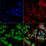 SMC-532_Alpha-Synuclein_Antibody_3F8_ICC-IF_Human_Neuroblastoma-cell-line-SK-N-BE_60X_Composite_1.png