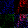 Mouse Anti-Alpha Synuclein Antibody [3F8] used in Immunocytochemistry/Immunofluorescence (ICC/IF) on Rat Primary hippocampal neurons treated to induce fibrils (SMC-532)