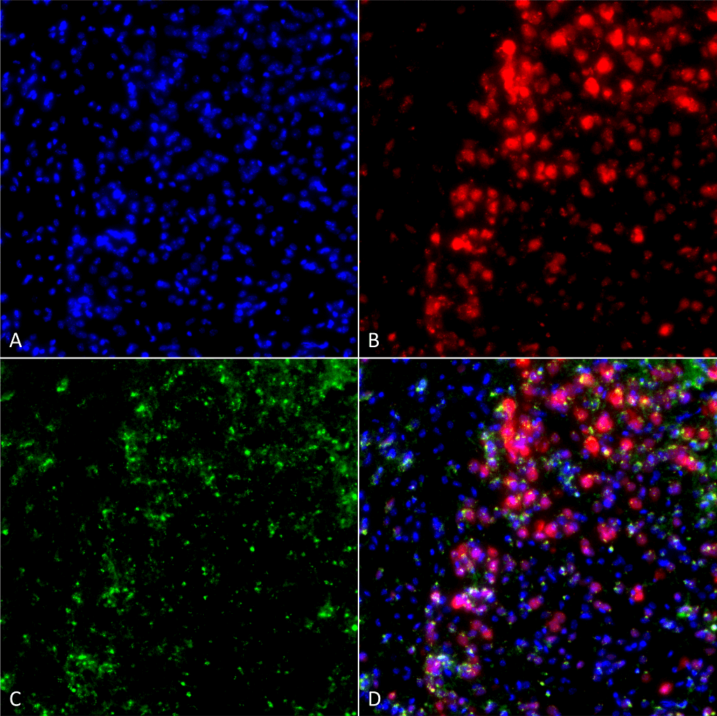 <p>Immunocytochemistry/Immunofluorescence analysis using Mouse Anti-Alpha Synuclein Monoclonal Antibody, Clone 3F8 (SMC-532). Tissue: Primary hippocampal neurons treated with active Alpha Synuclein Protein Aggregate (SPR-322) at 4 µg/ml to induce fibrils. Species: Rat. Fixation: 4% paraformaldehyde. Primary Antibody: Mouse Anti-Alpha Synuclein Monoclonal Antibody (SMC-532) at 1:200 for 24 hours at 4°C. Secondary Antibody: Goat Anti-Mouse Alexa Fluor 488 at 1:700 for 1 hour at RT. Counterstain: Guinea Pig Anti-NeuN (red) neuronal marker (Donkey Anti-Guinea Pig Alexa Fluor 647 1:700); DAPI (blue) nuclear stain at 1:6000, 1:3000 for 60 min at RT, 5 min at RT. Magnification: 20X. (A) DAPI (blue) nuclear stain. (B) NeuN neuronal marker (red). (C) Alpha Synuclein Antibody. (D) Composite.</p>
