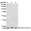 Mouse Anti-Alpha Synuclein Antibody [3F8] used in Western Blot (WB) on Human, Mouse, Rat Brain (SMC-532)