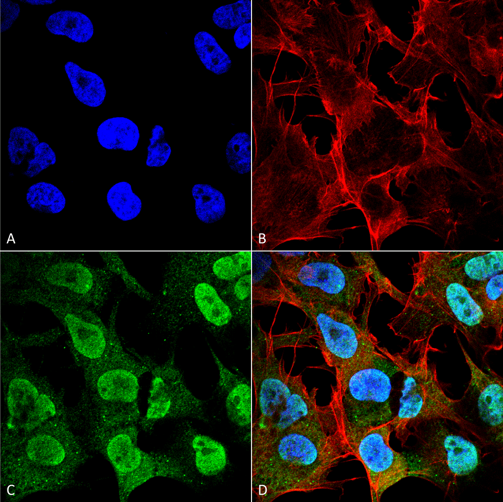 <p>Immunocytochemistry/Immunofluorescence analysis using Mouse Anti-Alpha Synuclein Monoclonal Antibody, Clone 4F1 (SMC-533). Tissue: Neuroblastoma cell line (SK-N-BE). Species: Human. Fixation: 4% Formaldehyde for 15 min at RT. Primary Antibody: Mouse Anti-Alpha Synuclein Monoclonal Antibody (SMC-533) at 1:100 for 60 min at RT. Secondary Antibody: Goat Anti-Mouse ATTO 488 at 1:200 for 60 min at RT. Counterstain: Phalloidin Texas Red F-Actin stain; DAPI (blue) nuclear stain at 1:1000, 1:5000 for 60 min at RT, 5 min at RT. Localization: Cytoplasm: medium; Nucleus: strong. Magnification: 60X. (A) DAPI (blue) nuclear stain. (B) Phalloidin Texas Red F-Actin stain. (C) Alpha Synuclein Antibody. (D) Composite.</p>
