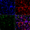 Mouse Anti-Alpha Synuclein Antibody [4F1] used in Immunocytochemistry/Immunofluorescence (ICC/IF) on Rat Primary hippocampal neurons treated to induce fibrils (SMC-533)