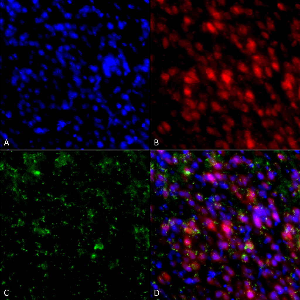 <p>Immunocytochemistry/Immunofluorescence analysis using Mouse Anti-Alpha Synuclein Monoclonal Antibody, Clone 4F1 (SMC-533). Tissue: Primary hippocampal neurons treated with active Alpha Synuclein Protein Aggregate (SPR-322) at 4 µg/ml to induce fibrils. Species: Rat. Fixation: 4% paraformaldehyde. Primary Antibody: Mouse Anti-Alpha Synuclein Monoclonal Antibody (SMC-533) at 1:200 for 24 hours at 4°C. Secondary Antibody: Goat Anti-Mouse Alexa Fluor 488 at 1:700 for 1 hour at RT. Counterstain: Guinea Pig Anti-NeuN (red) neuronal marker (Donkey Anti-Guinea Pig Alexa Fluor 647 1:700); DAPI (blue) nuclear stain at 1:6000, 1:3000 for 60 min at RT, 5 min at RT. Magnification: 20X. (A) DAPI (blue) nuclear stain. (B) NeuN neuronal marker (red). (C) Alpha Synuclein Antibody. (D) Composite.</p>
