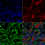 SMC-539_KDEL_Antibody_2C1_IHC_Rat_kidney_63X_1.png