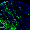 Mouse Anti-Thyroid Hormone Receptor Antibody [H43] used in Immunohistochemistry (IHC) on Human Thyroid Cancer (SMC-561)