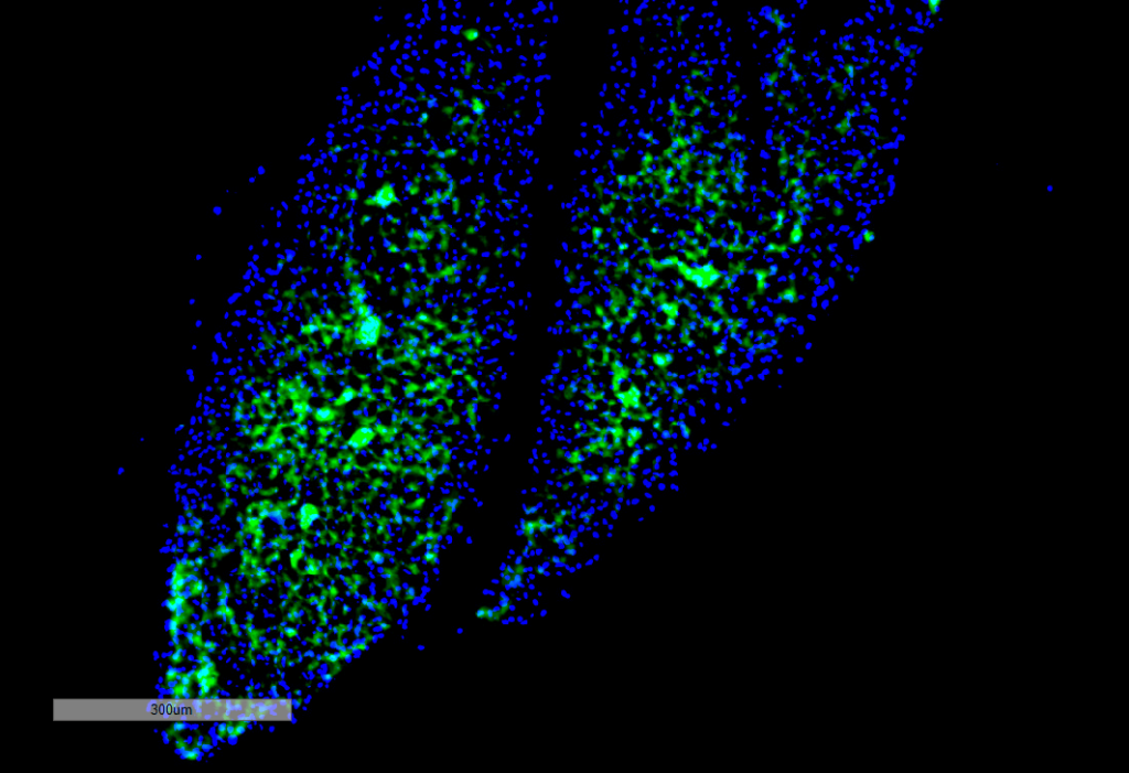 <p>Immunohistochemistry analysis using Mouse Anti-Thyroid Hormone Receptor Monoclonal Antibody, Clone H43 (SMC-561). Tissue: Thyroid. Species: Mouse. Primary Antibody: Mouse Anti-Thyroid Hormone Receptor Monoclonal Antibody (SMC-561) at 1:100 for Overnight at 4C, then 30 min at 37C. Secondary Antibody: Goat Anti-Mouse IgG (H+L): FITC for 45 min at 37C. Counterstain: DAPI for 3 min at RT. Magnification: 7.5X.</p>
