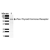 Mouse Anti-Thyroid Hormone Receptor Antibody [H43] used in Western Blot (WB) on Human Hep G2 Hepatoblastoma Cell lysate (SMC-561)