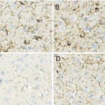 SMC-600_Alpha-Synuclein-pSer129_Antibody_J18_IHC_Mouse_Brain_1.png