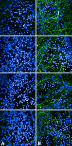 Rabbit Anti-Tau Antibody (pSer202/ pThr205) [AH36] used in Immunocytochemistry/Immunofluorescence (ICC/IF) on Human iPSC-derived cortical excitatory neurons (SMC-601)