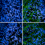 SMC-601_Tau_Antibody_AH36_ICC-IF_Human_iPSC-derived-cortical-excitatory-neurons_1.png