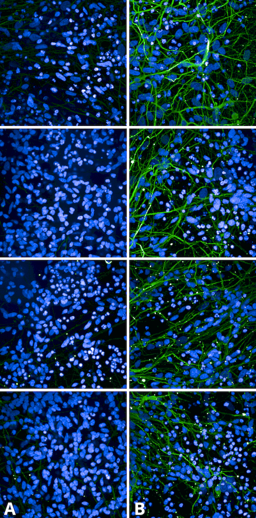 <p>Immunocytochemistry/Immunofluorescence analysis using Rabbit Anti-Tau Monoclonal Antibody, Clone AH36 (SMC-601). Tissue: iPSC-derived cortical excitatory neurons. Species: Human. Primary Antibody: Rabbit Anti-Tau Monoclonal Antibody (SMC-601) at 1:500 for Overnight. Secondary Antibody: Donkey anti-rabbit: Alexa Fluor 488 at 1:1000. Counterstain: DAPI. A) iPSC-derived neurons from non-demented control (NDC). B) iPSC-derived neurons from subject with P301L MAPT mutation. Images acquired using an automated Opera Phoenix system. Each field of view is a max projection from 10 planes of 1 μm stacks.. Courtesy of: Francesco Paonessa.</p>
