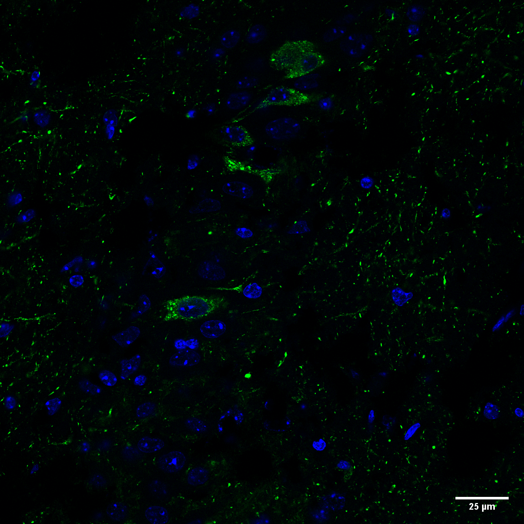 Rabbit Anti-Tau Antibody (pSer202/ pThr205) [AH36] used in Immunohistochemistry (IHC) on Mouse Brain slice (SMC-601)