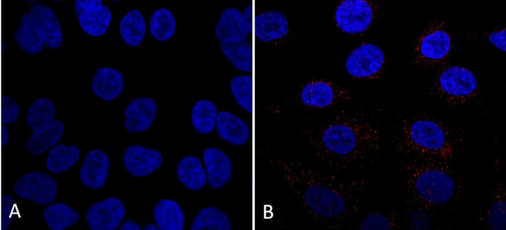 <p>Immunocytochemistry/Immunofluorescence analysis using Mouse Anti-VPS35 Monoclonal Antibody, Clone 7E4 (SMC-602). Tissue: A549 cells. Species: Human. Primary Antibody: Mouse Anti-VPS35 Monoclonal Antibody (SMC-602) at 1:5 (tissue culture supernatant). Secondary Antibody: Donkey anti-mouse: Alexa Fluor 594 at 1:4000 in 0.2% BSA PBS. Counterstain: DAPI. Localization: Vesicles. A) VPS35 KO A549 cells B) WT A549 cells. Courtesy of: Dario Alessi Lab, University of Dundee.</p>
