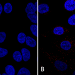 SMC-602_VPS35_Antibody_7E4_ICC-IF_Human_A549-cells_1.png