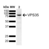 Mouse Anti-VPS35 Antibody [7E4] used in Western Blot (WB) on Human SH-SY5Y lysates (SMC-602)