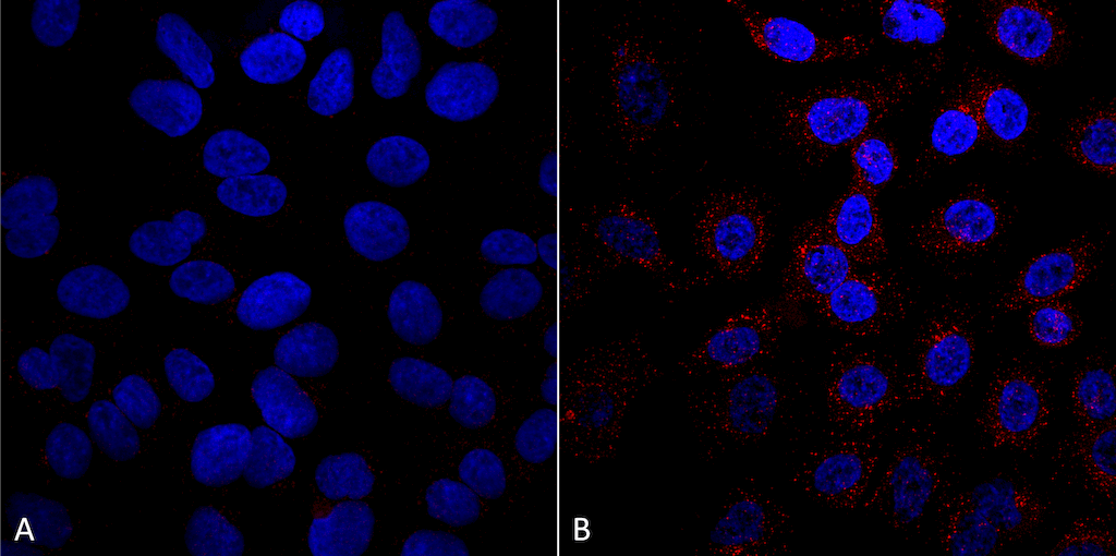 <p>Immunocytochemistry/Immunofluorescence analysis using Mouse Anti-VPS35 Monoclonal Antibody, Clone 5A9 (SMC-603). Tissue: A549 cells. Species: Human. Primary Antibody: Mouse Anti-VPS35 Monoclonal Antibody (SMC-603) at 1:5 (tissue culture supernatant). Secondary Antibody: Donkey anti-mouse: Alexa Fluor 594 at 1:4000 in 0.2% BSA PBS. Counterstain: DAPI. Localization: Vesicles. A) VPS35 KO A549 cells B) WT A549 cells. Courtesy of: Dario Alessi Lab, University of Dundee.</p>
