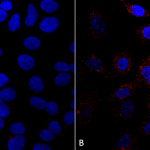 SMC-603_VPS35_Antibody_5A9_ICC-IF_Human_A549-cells_1.png