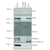 Mouse Anti-VPS35 Antibody [5A9] used in Immunoprecipitation (IP) on Human A549 cells (SMC-603)