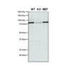 Mouse Anti-VPS35 Antibody [5A9] used in Western Blot (WB) on Human, Mouse A549, MEF (SMC-603)