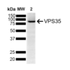 Mouse Anti-VPS35 Antibody [5A9] used in Western Blot (WB) on Human SH-SY5Y (SMC-603)