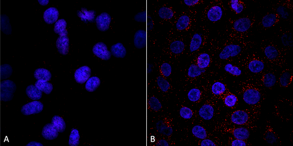 <p>Immunocytochemistry/Immunofluorescence analysis using Mouse Anti-VPS35 Monoclonal Antibody, Clone 8A3 (SMC-604). Tissue: A549 cells. Species: Human. Primary Antibody: Mouse Anti-VPS35 Monoclonal Antibody (SMC-604) at 1:5 (tissue culture supernatant). Secondary Antibody: Donkey anti-mouse: Alexa Fluor 594 at 1:4000 in 0.2% BSA PBS. Counterstain: DAPI. Localization: Vesicles. A) VPS35 KO A549 cells B) WT A549 cells. Courtesy of: Dario Alessi Lab, University of Dundee.</p>

