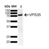 Mouse Anti-VPS35 Antibody [8A3] used in Western Blot (WB) on Human SH-SY5Y (SMC-604)