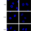 Mouse Anti-VPS35 Antibody [10A8] used in Immunocytochemistry/Immunofluorescence (ICC/IF) on Human A549 WT, VPS35 KO cells (SMC-605)