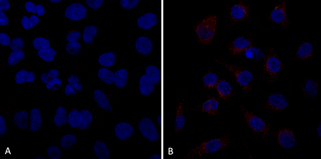 <p>Immunocytochemistry/Immunofluorescence analysis using Mouse Anti-VPS35 Monoclonal Antibody, Clone 10A8 (SMC-605). Tissue: A549 cells. Species: Human. Primary Antibody: Mouse Anti-VPS35 Monoclonal Antibody (SMC-605) at 1:5 (tissue culture supernatant). Secondary Antibody: Donkey anti-mouse: Alexa Fluor 594 at 1:4000 in 0.2% BSA PBS. Counterstain: DAPI. Localization: Vesicles. A) VPS35 KO A549 cells B) WT A549 cells. Courtesy of: Dario Alessi Lab, University of Dundee.</p>
