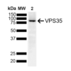 Mouse Anti-VPS35 Antibody [10A8] used in Western Blot (WB) on Human SH-SY5Y (SMC-605)