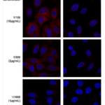 SMC-610_DENND4C_Antibody_3E8_ICC-IF_Human_A549-cells_1.png